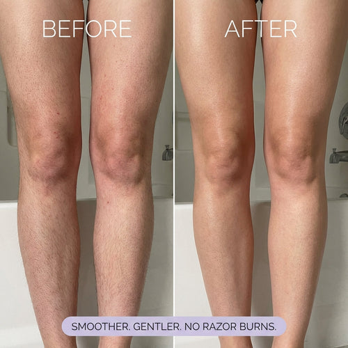 Koas Hair Removal Mousse
